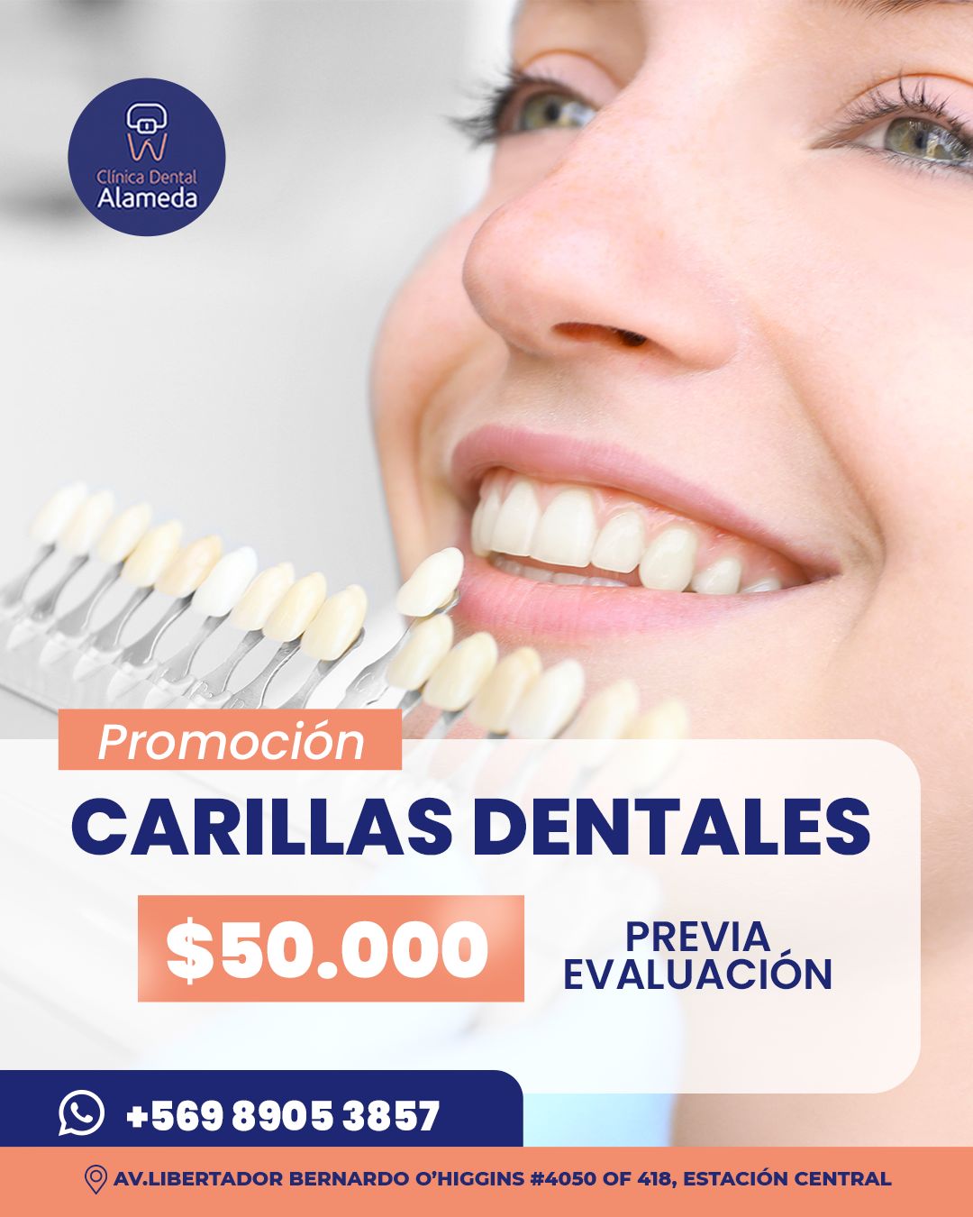 Promoción Carillas Dentales